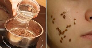 Keten Tohumunun Cilde Faydaları