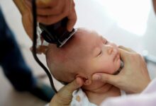 Bebeklerde Saç Kazıtmanın Faydaları Ve Zararları