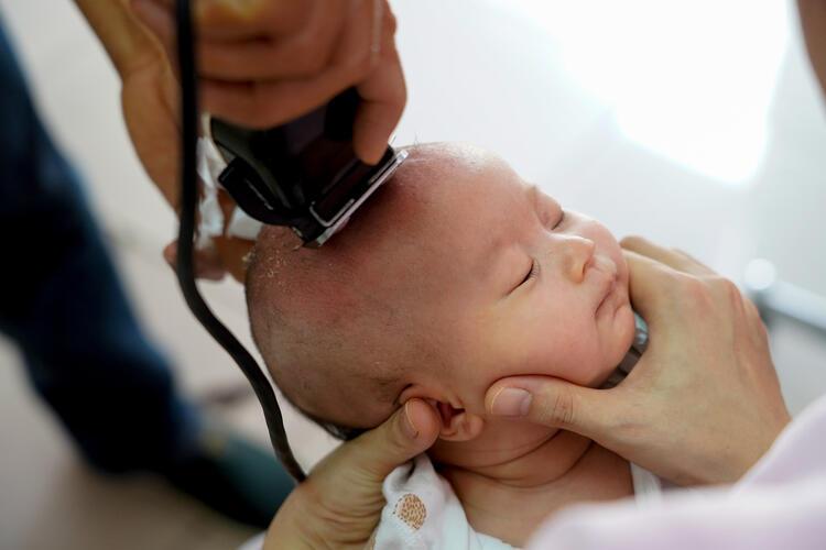 Bebeklerde Saç Kazıtmanın Faydaları Ve Zararları