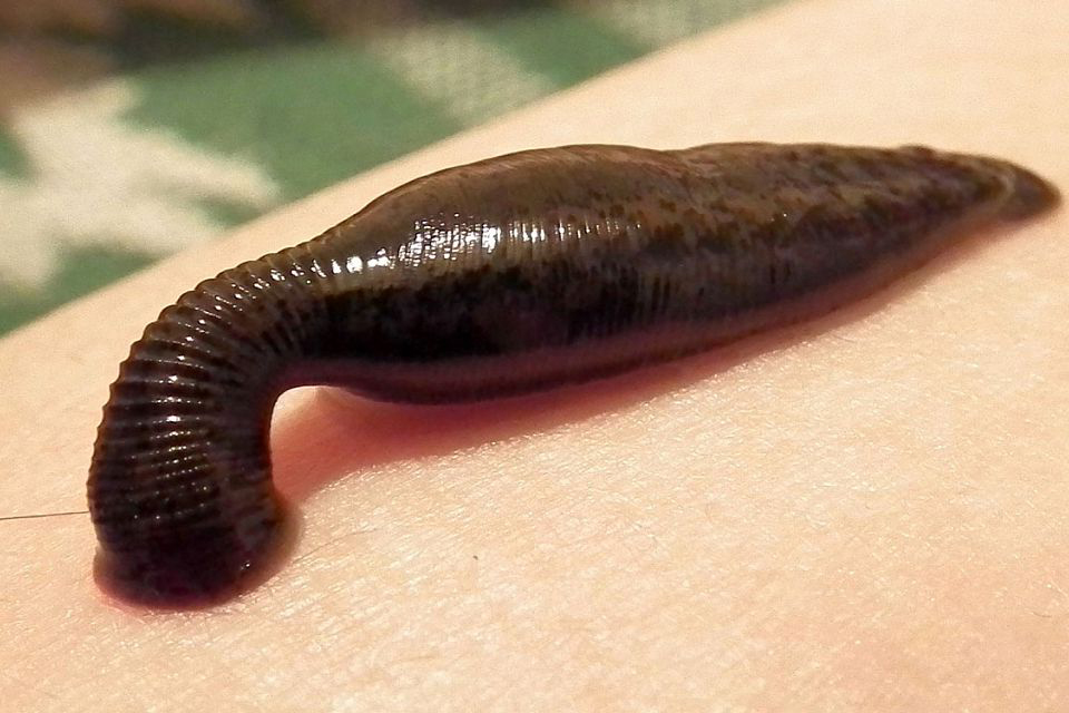 Kulak Arkası Sülük Faydaları