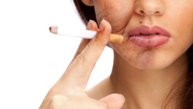 Sigaranın Yüze Zararları Sigaranın Yüze Zararları