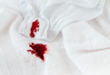 Vişne Suyu Lekesi Çıkar mı? İşte Pratik Çözümler ve Püf Noktaları