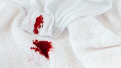 Vişne Suyu Lekesi Çıkar mı? İşte Pratik Çözümler ve Püf Noktaları Vişne Suyu Lekesi Çıkar mı? İşte Pratik Çözümler ve Püf Noktaları